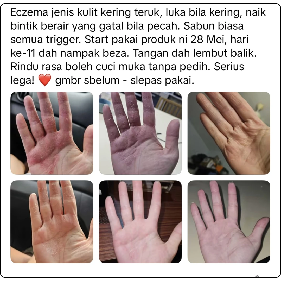 review 1